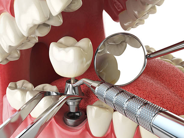 Best Emergency Treatment for Toothache in Flagtown, NJ